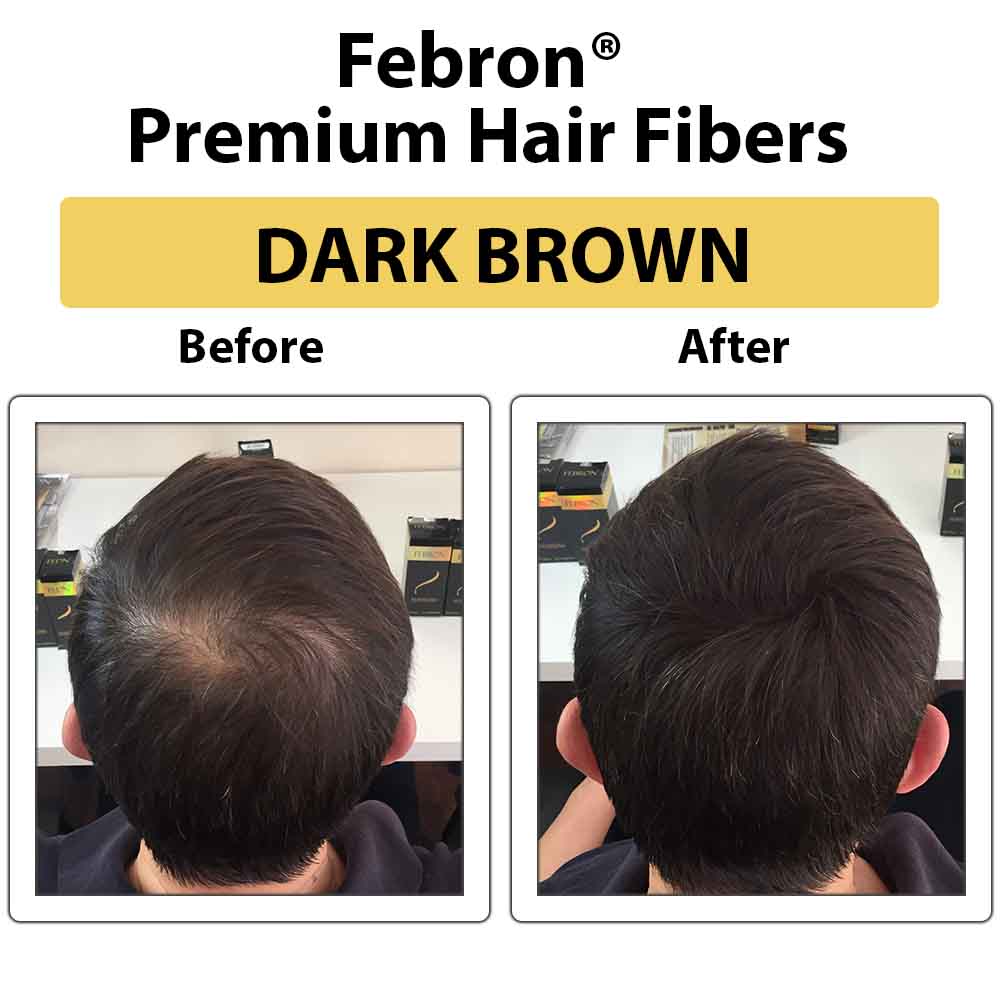Febron® SILVER KIT 10% OFF | Hair Thickening Fibers Kit
