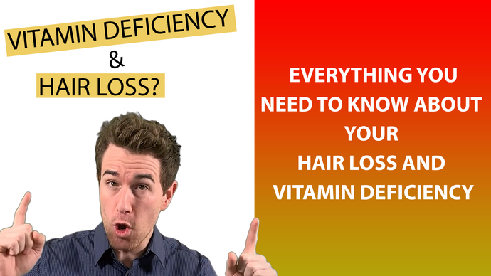 Is Hair Loss and Thinning Hair a Vitamin Deficiency ?  (Critical Info To Know & Prevent) - By Febron