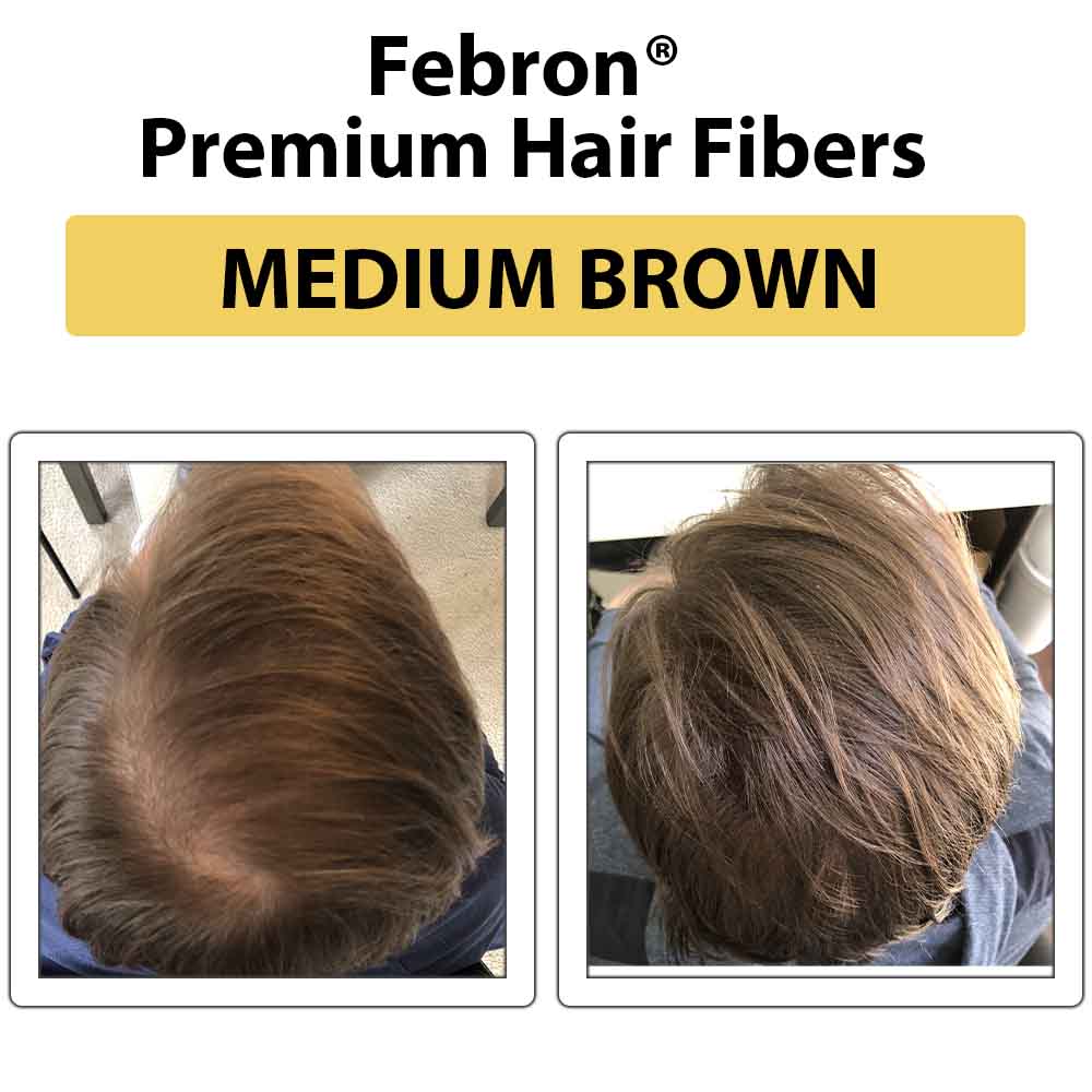Febron Hair Building Fibers 30g 1.06oz - The Perfect Hair Loss Concealer For Men & Women