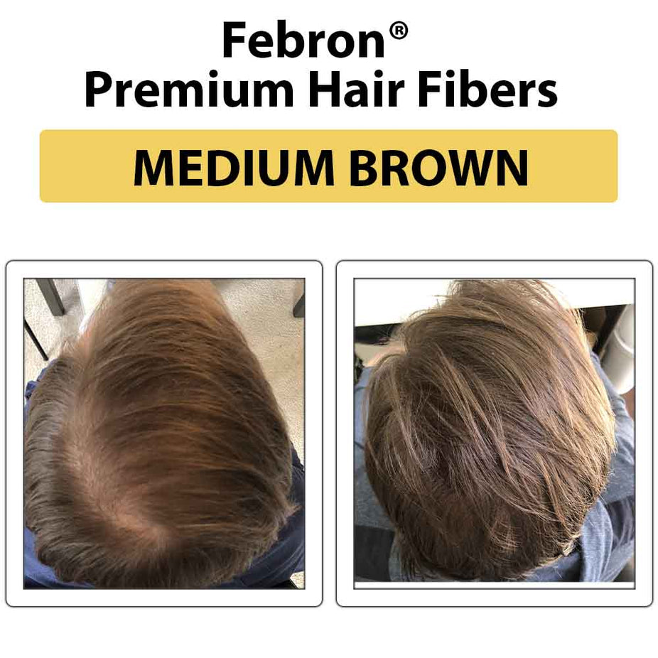 Febron Hair Building Fibers 30g 1.06oz - The Perfect Hair Loss Concealer For Men & Women