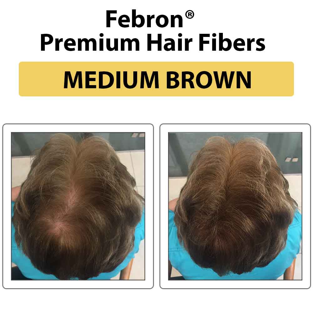 Febron Hair Building Fibers 30g 1.06oz - The Perfect Hair Loss Concealer For Men & Women
