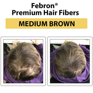 Before and after hair coverage using FEBRON Platinum Kit