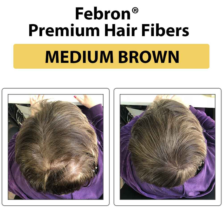 Febron Hair Building Fibers 30g 1.06oz - The Perfect Hair Loss Concealer For Men & Women
