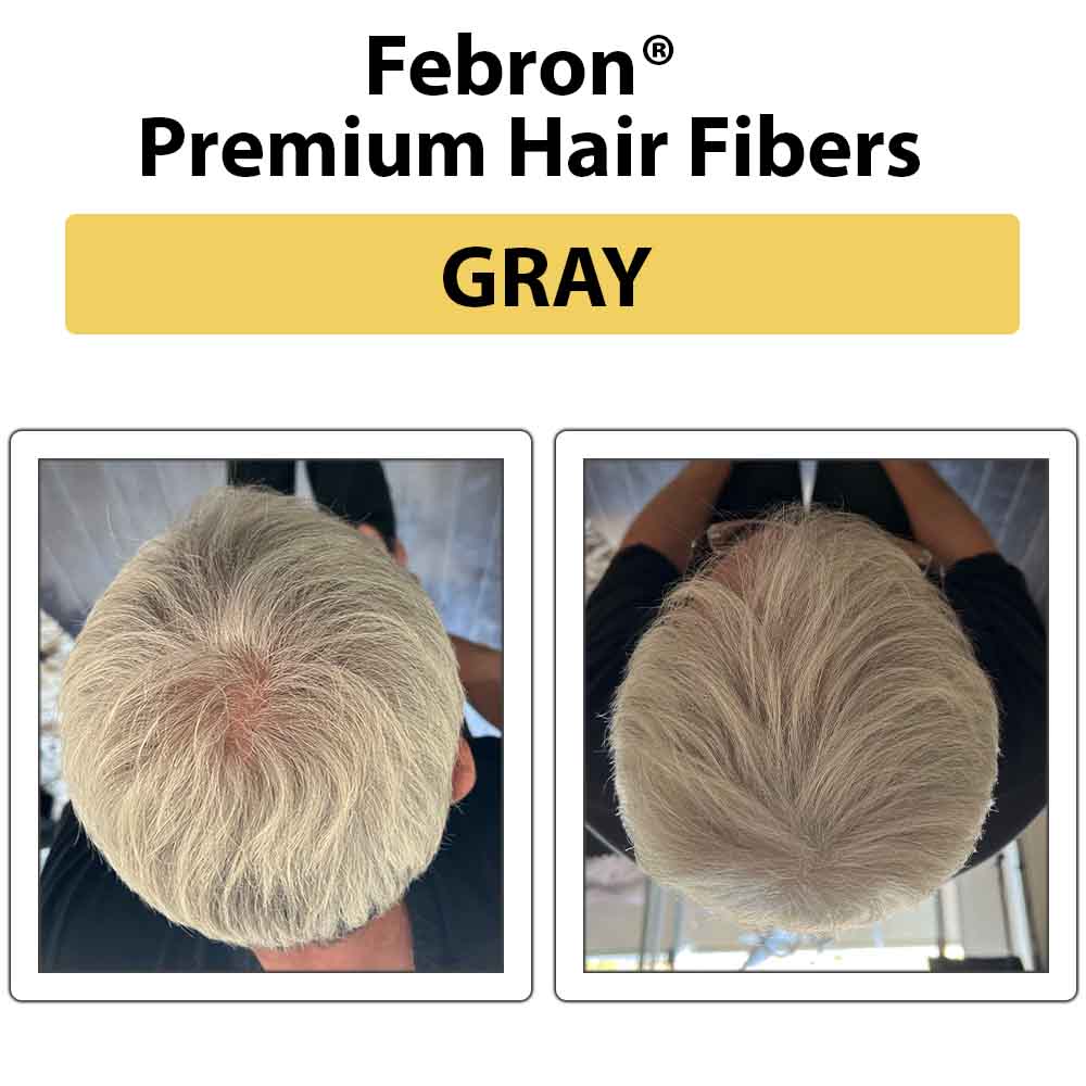 Febron Hair Building Fibers 30g 1.06oz - The Perfect Hair Loss Concealer For Men & Women