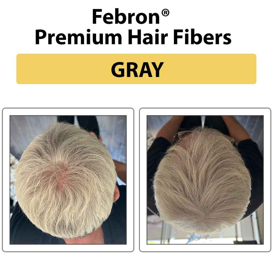 Febron Hair Building Fibers 30g 1.06oz - The Perfect Hair Loss Concealer For Men & Women