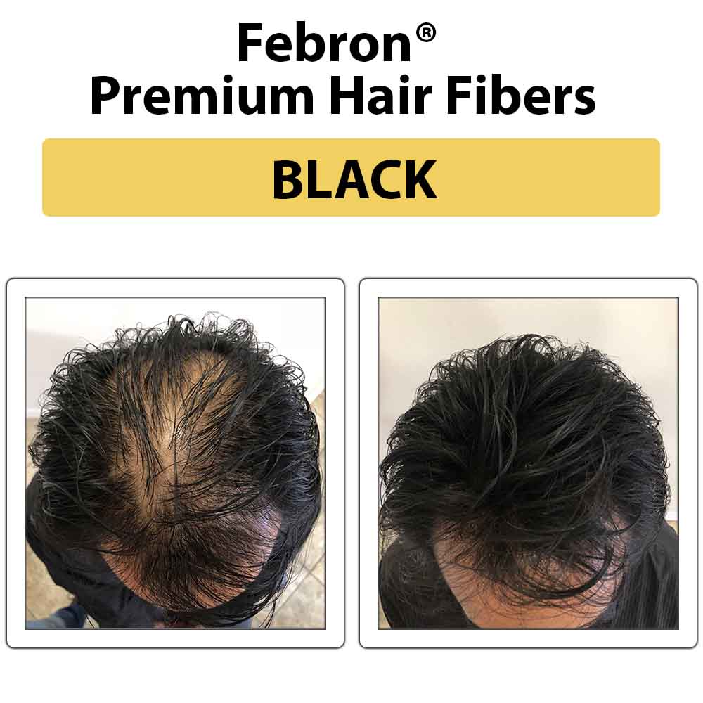Febron Hair Building Fibers 30g 1.06oz - The Perfect Hair Loss Concealer For Men & Women