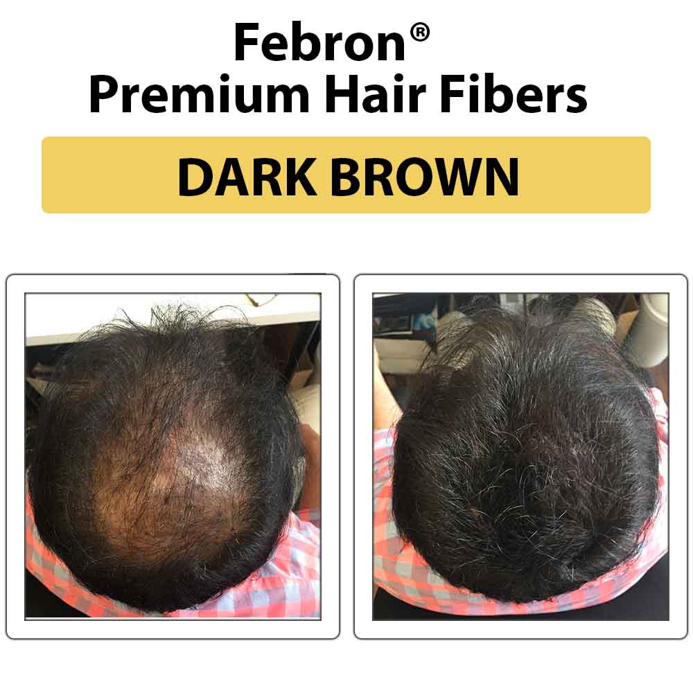Febron Hair Building Fibers 30g 1.06oz - The Perfect Hair Loss Concealer For Men & Women