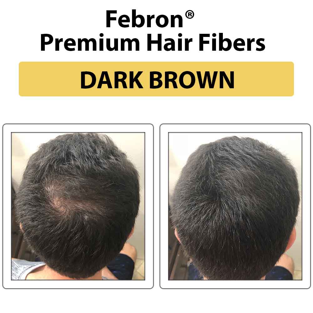 Febron Hair Building Fibers 30g 1.06oz - The Perfect Hair Loss Concealer For Men & Women