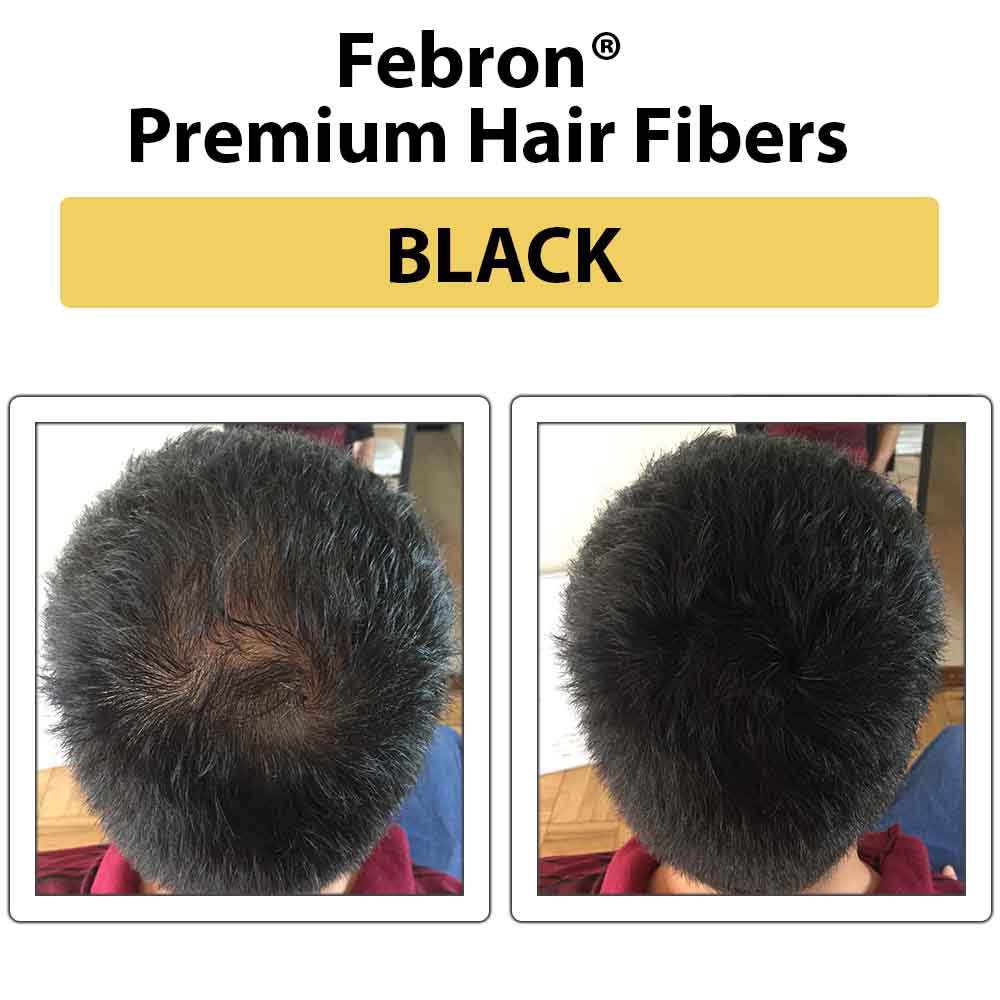 Febron® Hair Fibers FREE SAMPLE (Limited Time Only)