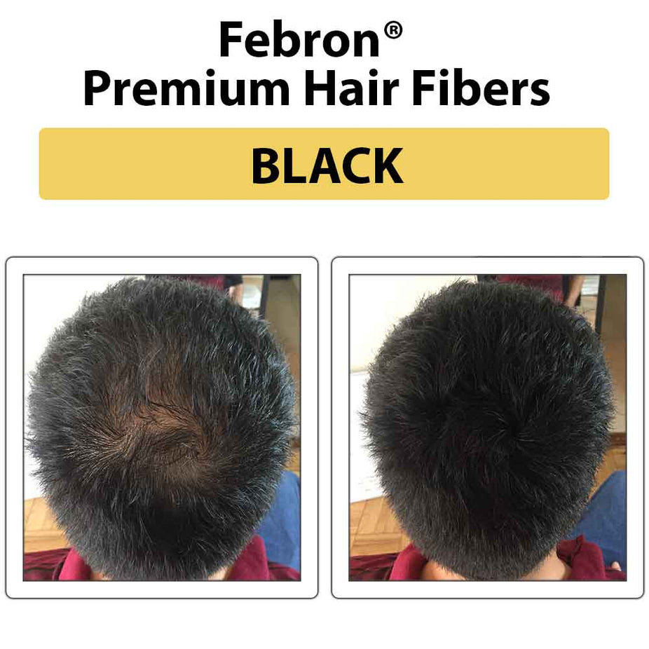Febron Hair Building Fibers 30g 1.06oz - The Perfect Hair Loss Concealer For Men & Women