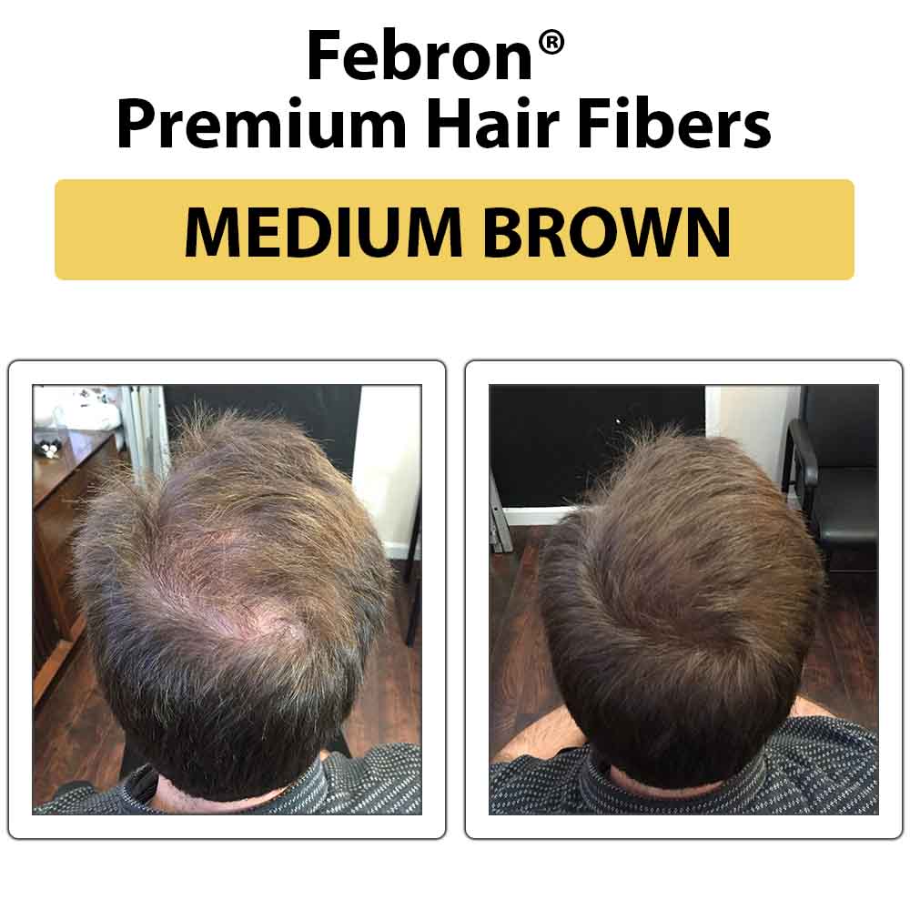 Febron Hair Building Fibers 30g 1.06oz - The Perfect Hair Loss Concealer For Men & Women