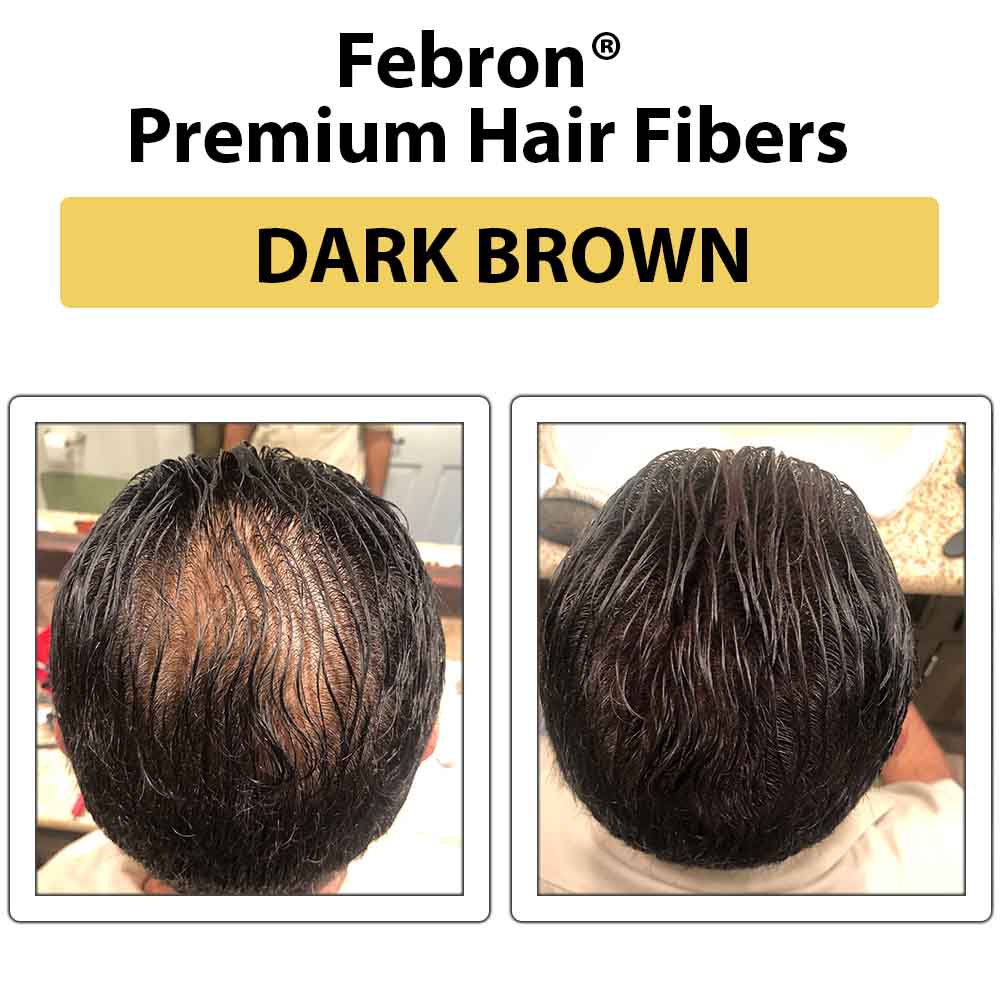 Febron Hair Building Fibers 30g 1.06oz - The Perfect Hair Loss Concealer For Men & Women