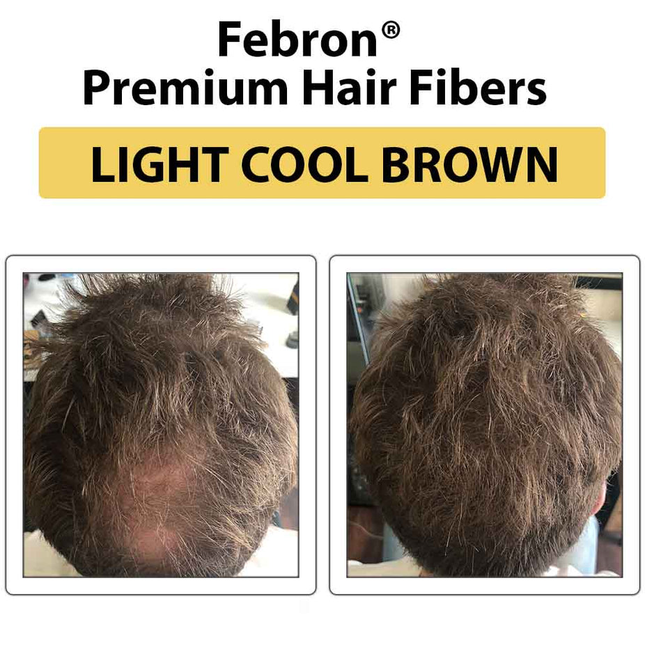 Febron Hair Building Fibers 30g 1.06oz - The Perfect Hair Loss Concealer For Men & Women