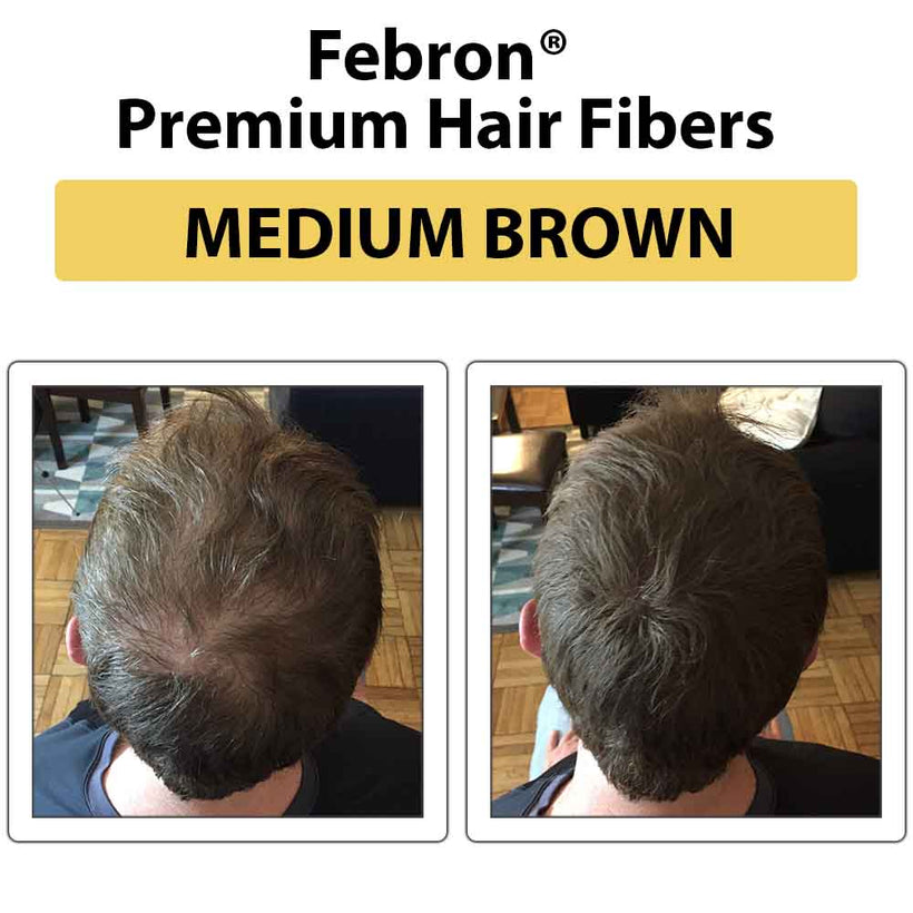 Blonde hair coverage using FEBRON Platinum Kit on frontal hairline