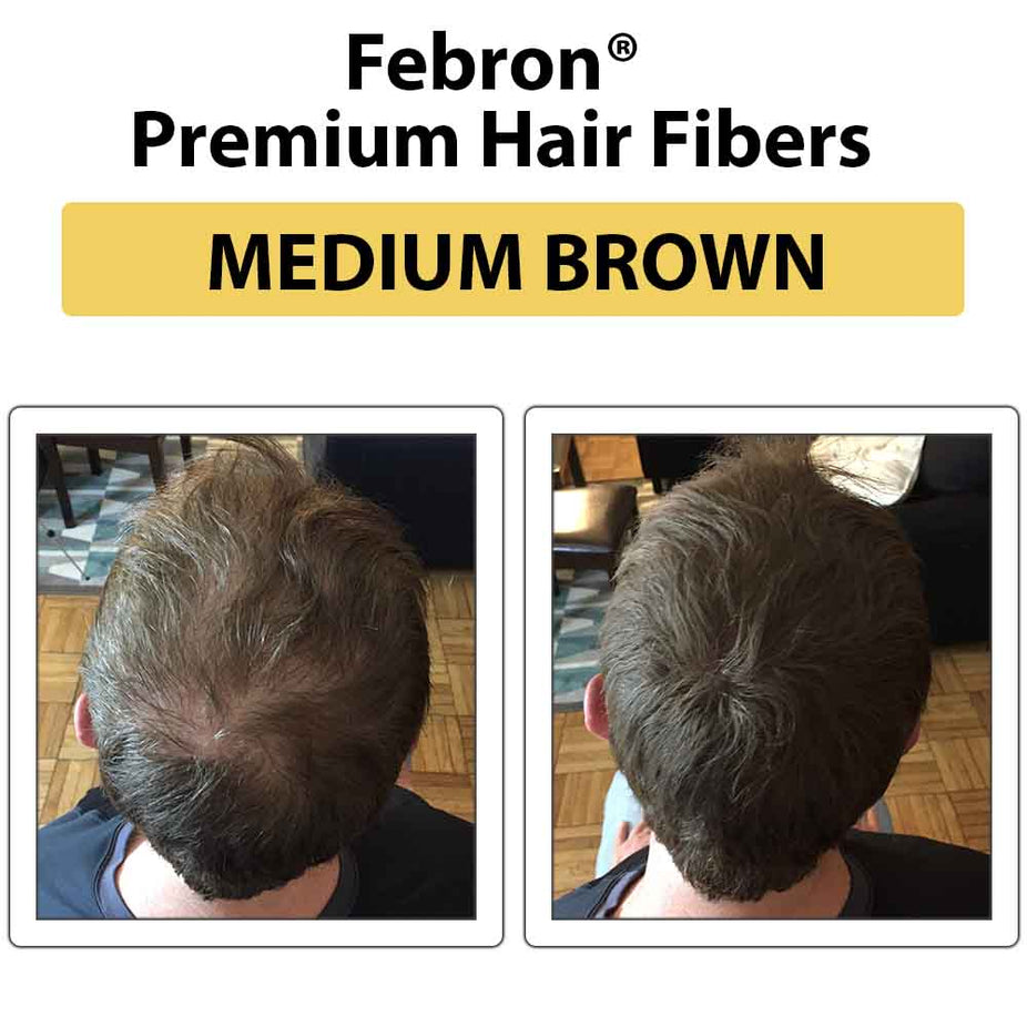 Febron Hair Building Fibers 30g 1.06oz - The Perfect Hair Loss Concealer For Men & Women