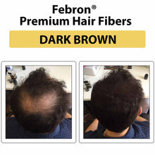 Load image into Gallery viewer,  Thicken Crown Hair Naturally Real user results using FEBRON Platinum Kit for hair volume and thickness look
