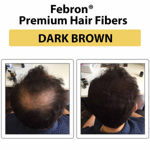  Thicken Crown Hair Naturally Real user results using FEBRON Platinum Kit for hair volume and thickness look