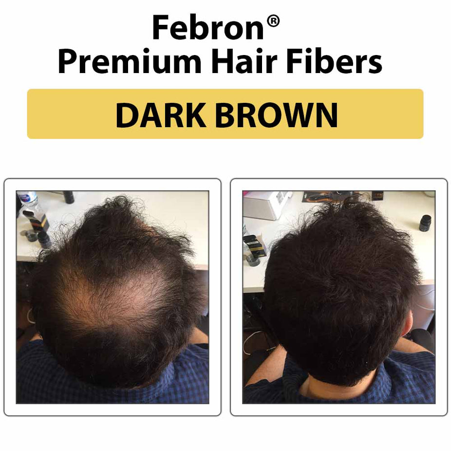 Febron Hair Building Fibers 30g 1.06oz - The Perfect Hair Loss Concealer For Men & Women