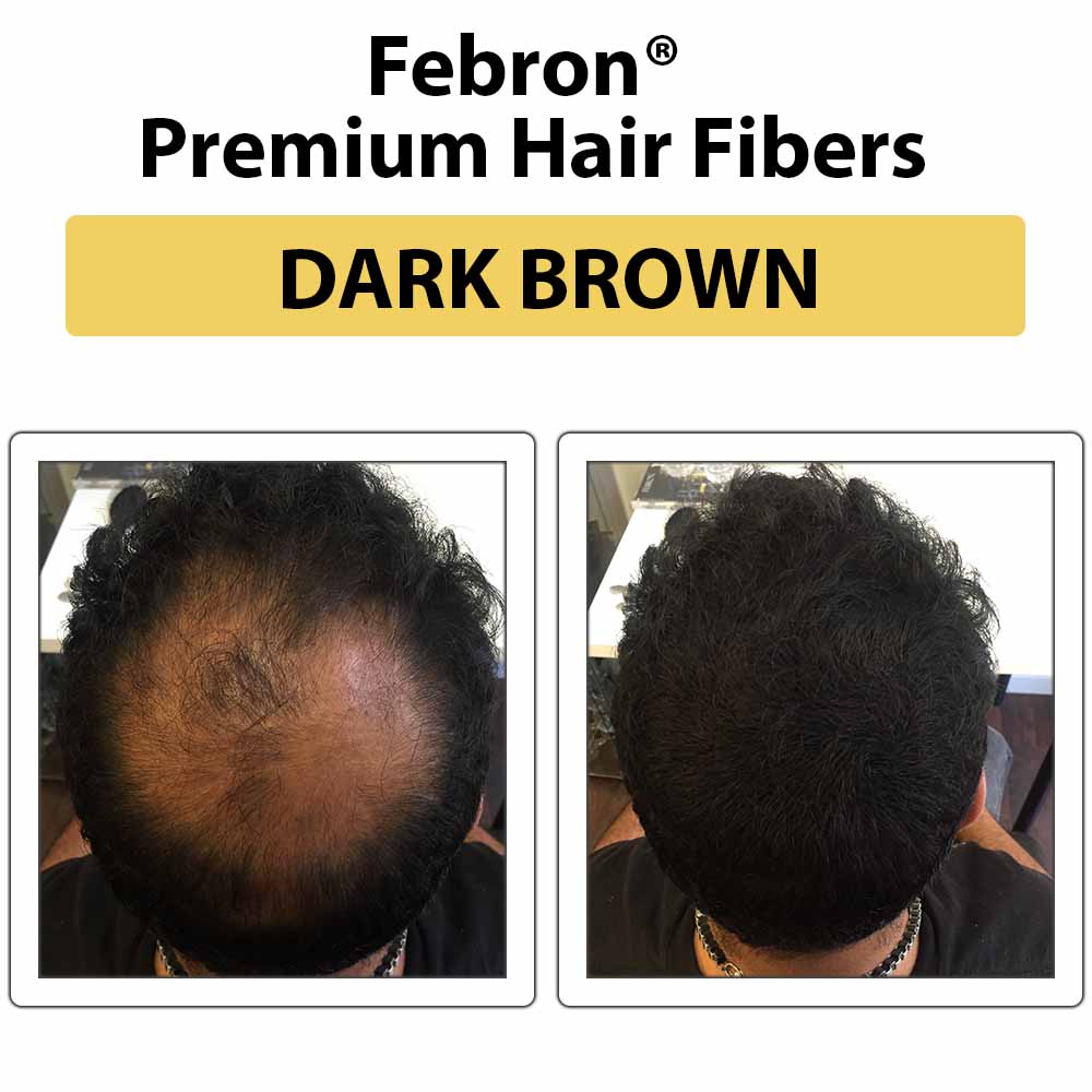 Febron® Hair Fibers FREE SAMPLE (Limited Time Only)