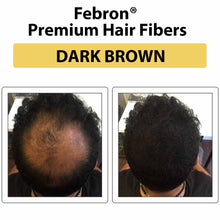Load image into Gallery viewer, FEBRON Proteron DHT Blocker capsules for root cause hair wellness
