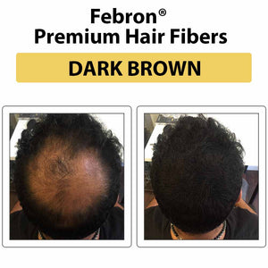FEBRON Proteron DHT Blocker capsules for root cause hair wellness