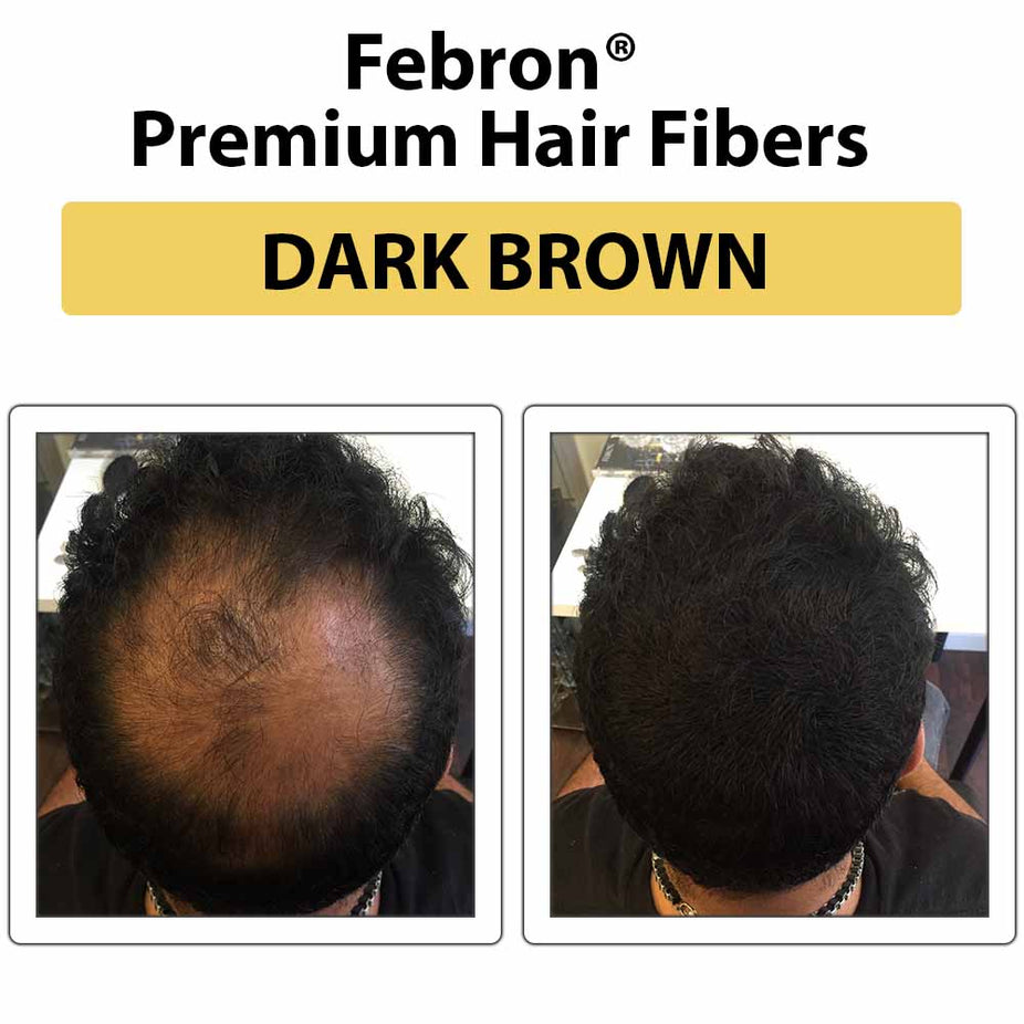 Febron Hair Building Fibers 30g 1.06oz - The Perfect Hair Loss Concealer For Men & Women