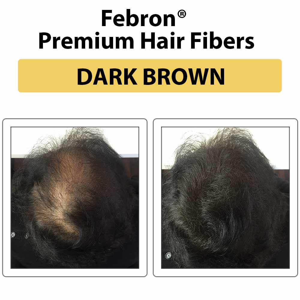 Febron Hair Building Fibers 30g 1.06oz - The Perfect Hair Loss Concealer For Men & Women