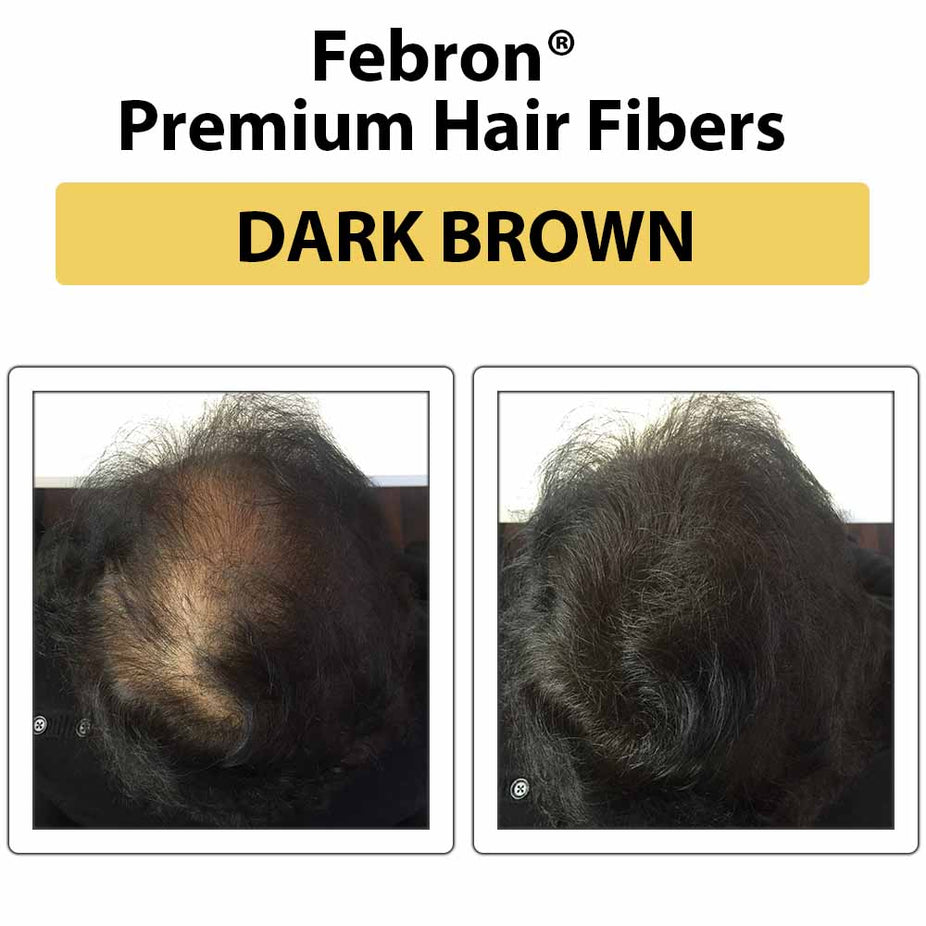 Febron Hair Building Fibers 30g 1.06oz - The Perfect Hair Loss Concealer For Men & Women