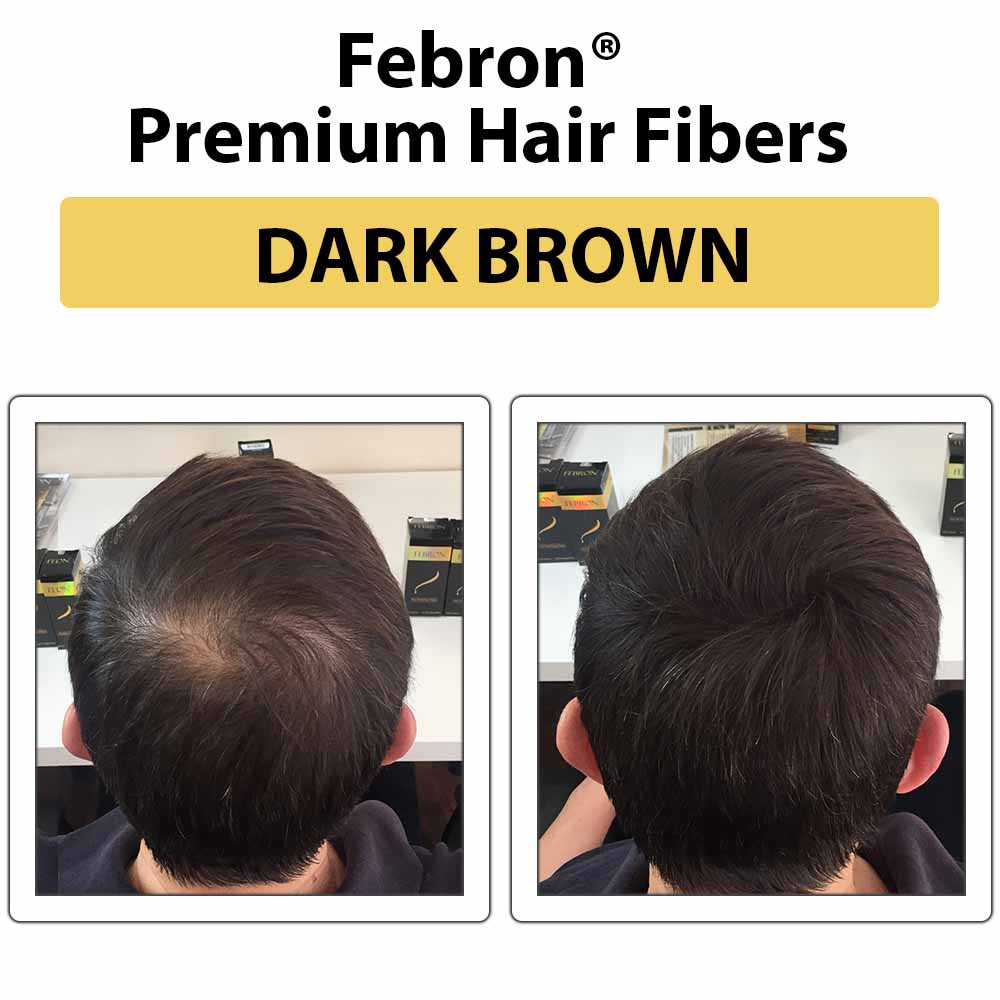 Febron Hair Building Fibers 30g 1.06oz - The Perfect Hair Loss Concealer For Men & Women