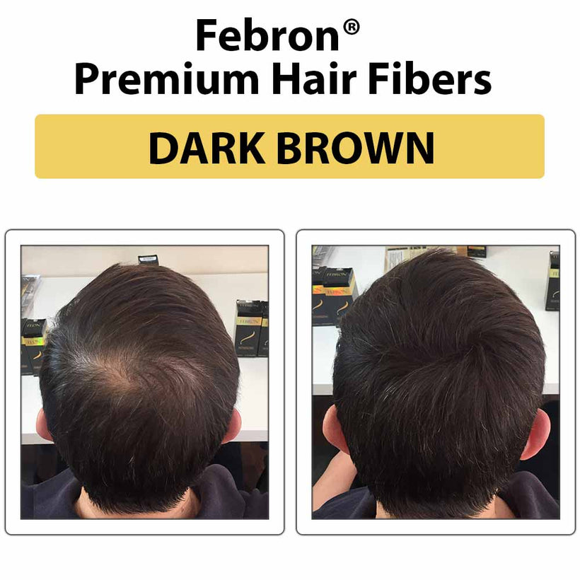 FEBRON's premium hair concealer solution for confidence and coverage