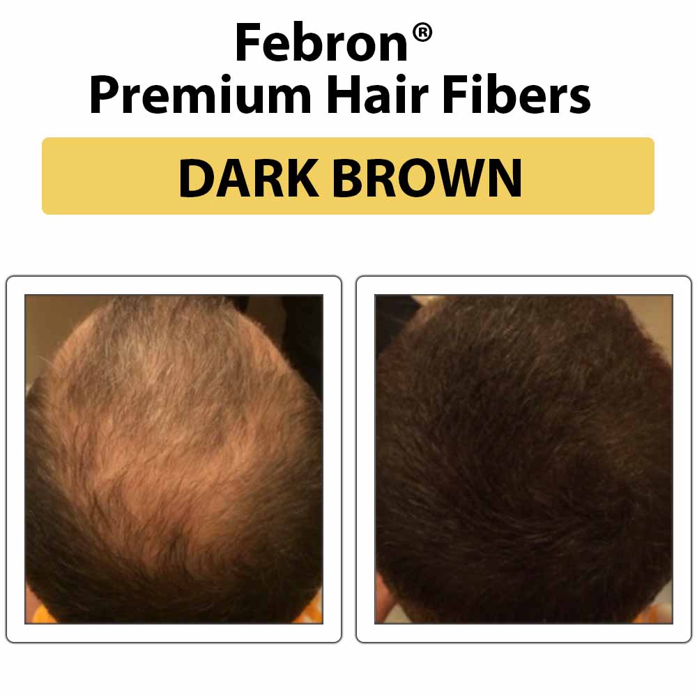 Febron Hair Building Fibers 30g 1.06oz - The Perfect Hair Loss Concealer For Men & Women