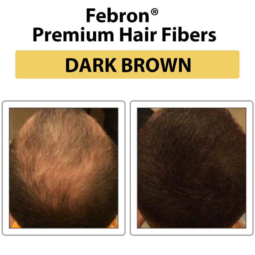 FEBRON Gold Pro Kit for beginners with thinning hair coverage tools