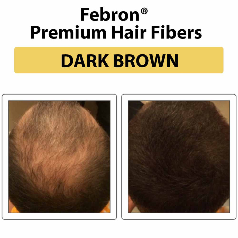 Febron Hair Building Fibers 30g 1.06oz - The Perfect Hair Loss Concealer For Men & Women