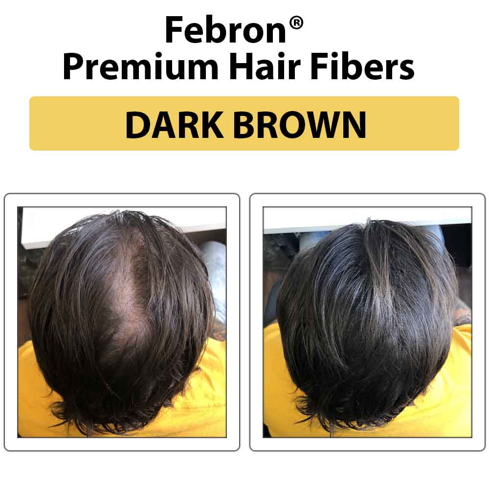 Febron Hair Building Fibers 30g 1.06oz - The Perfect Hair Loss Concealer For Men & Women