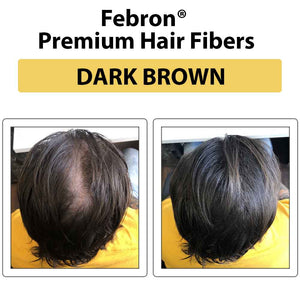 Best hair building fibers for women’s thinning hairline by FEBRON
