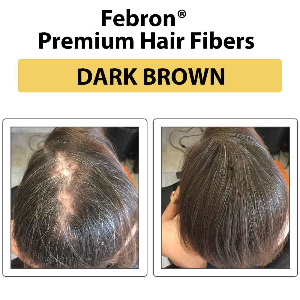 Febron Hair Building Fibers 30g 1.06oz - The Perfect Hair Loss Concealer For Men & Women