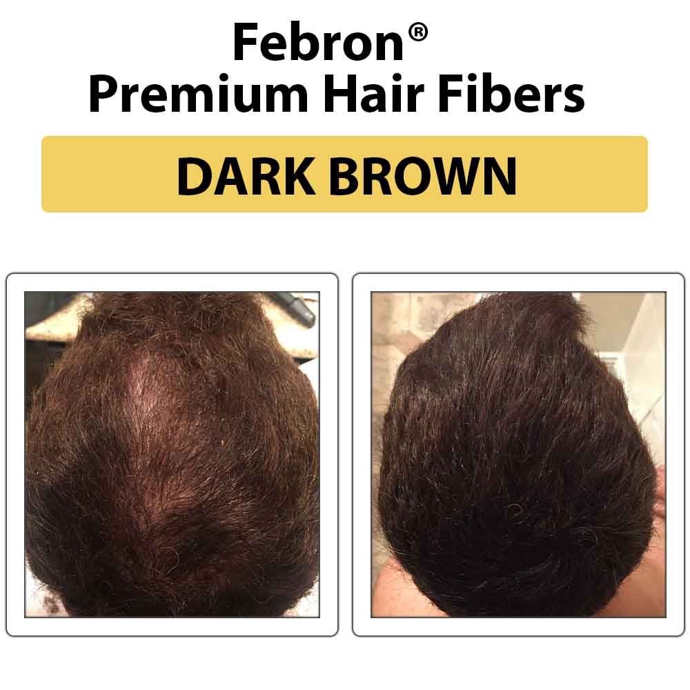 Febron Hair Building Fibers 30g 1.06oz - The Perfect Hair Loss Concealer For Men & Women