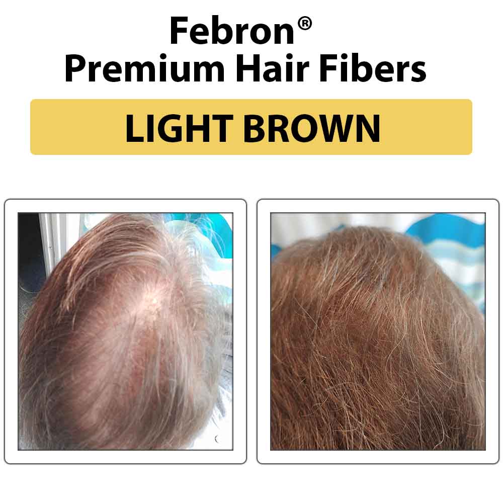 Febron Hair Building Fibers 30g 1.06oz - The Perfect Hair Loss Concealer For Men & Women