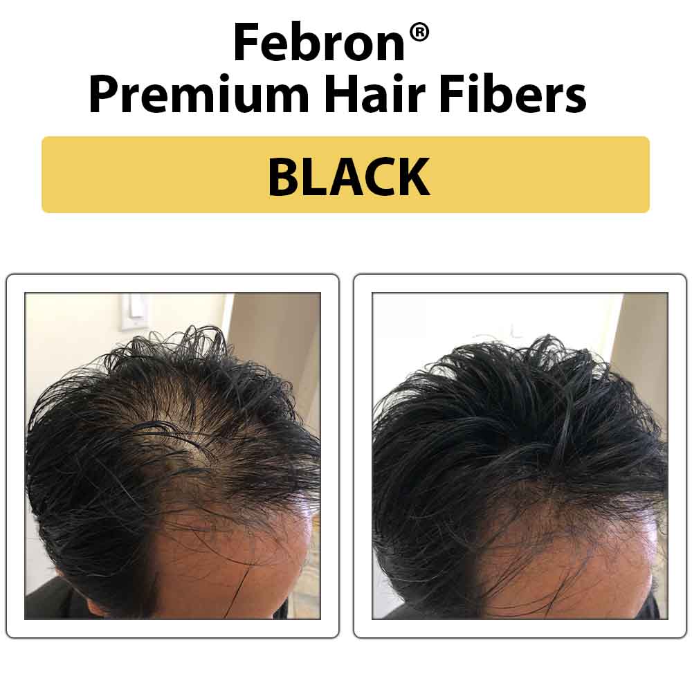 Febron Hair Building Fibers 30g 1.06oz - The Perfect Hair Loss Concealer For Men & Women