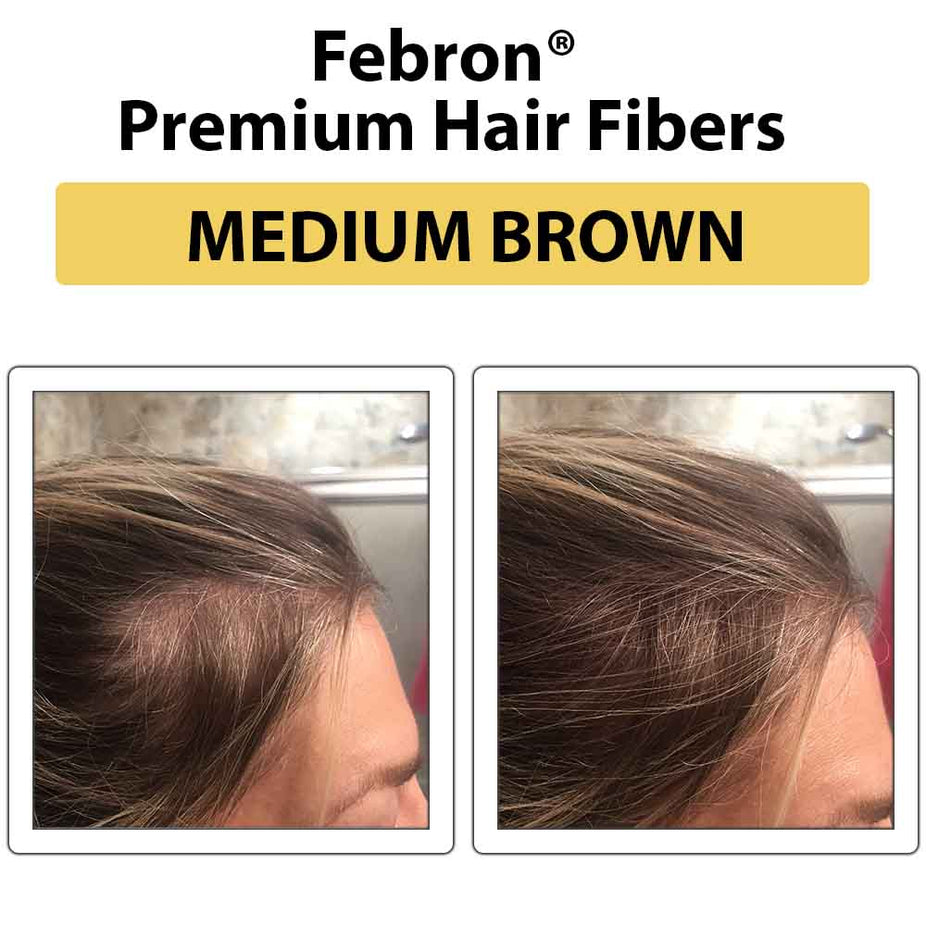 Febron Hair Building Fibers 30g 1.06oz - The Perfect Hair Loss Concealer For Men & Women