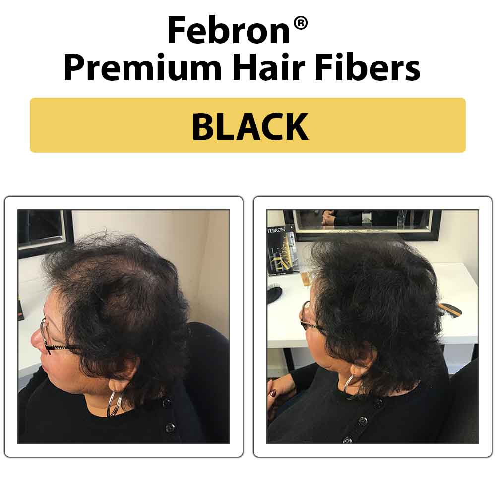 Febron Hair Building Fibers 30g 1.06oz - The Perfect Hair Loss Concealer For Men & Women