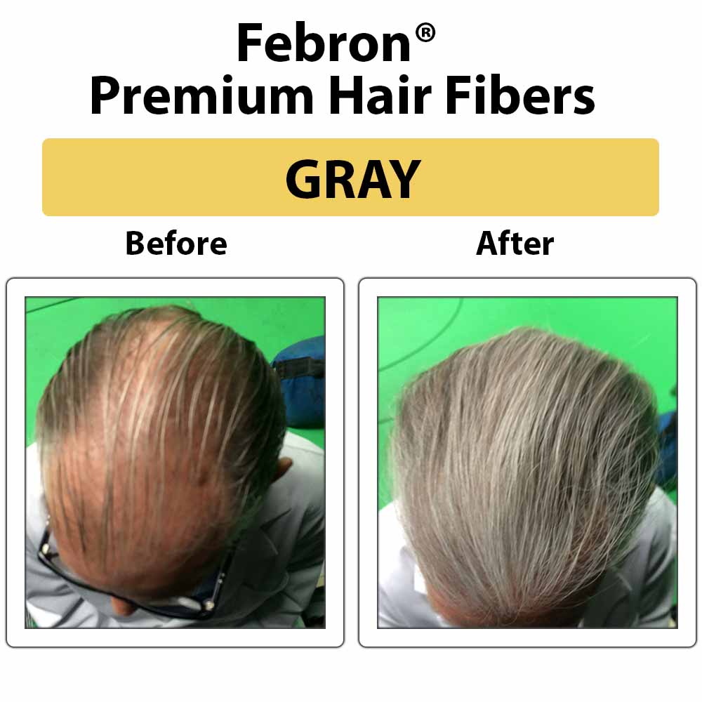 Febron® SILVER KIT 10% OFF | Hair Thickening Fibers Kit