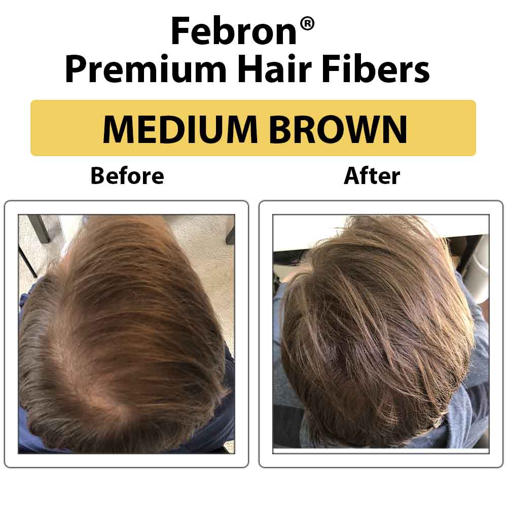 Febron® SILVER KIT 10% OFF | Hair Thickening Fibers Kit