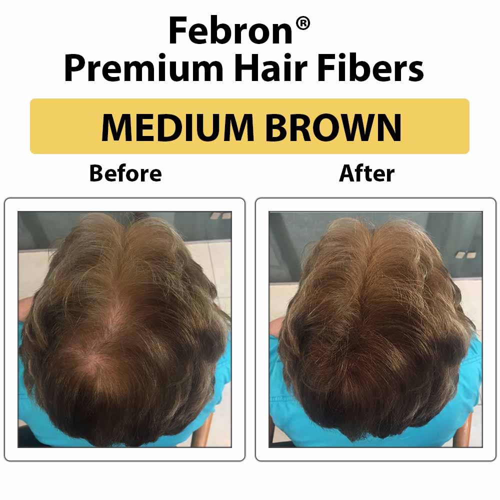 Febron® SILVER KIT 10% OFF | Hair Thickening Fibers Kit