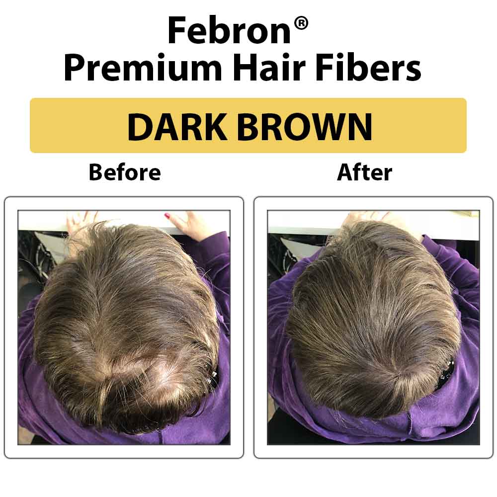 Febron® SILVER KIT 10% OFF | Hair Thickening Fibers Kit