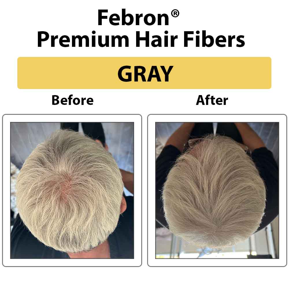 FEBRON Premium Hair Building Fibers & Thinning Hair Solution Fit Men