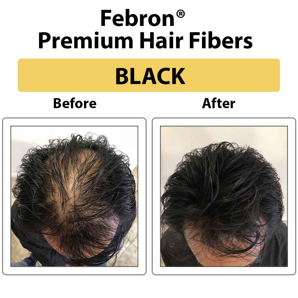 Hair Fibers: Use, Side Effects & Application – Ensoul India | Hair Building  Fibers Online in India | Hair Growth Products