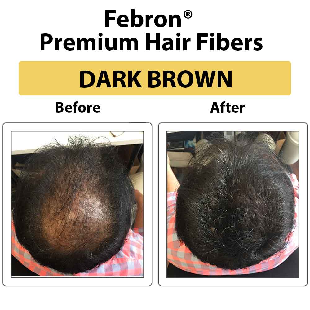 3 IN 1 Premium Febron Hair Building Fibers | Febron
