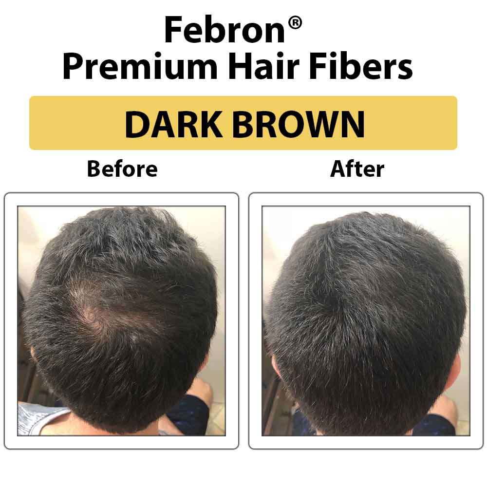 3 IN 1 Premium Febron Hair Building Fibers | Febron