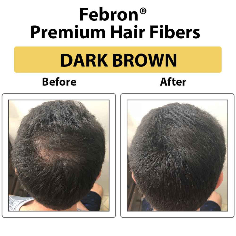 3 IN 1 Premium Febron Hair Building Fibers | Febron